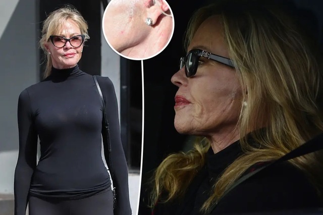 The Price of Perfection: Why Melanie Griffith’s New Face is a Brutal Warning to Every Woman in Hollywood